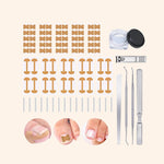 Load image into Gallery viewer, Professional Ingrown Nail Corrector Set

