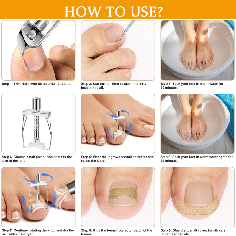 Professional Ingrown Nail Corrector Set