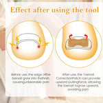 Load image into Gallery viewer, Professional Ingrown Nail Corrector Set
