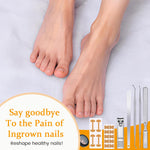 Load image into Gallery viewer, Professional Ingrown Nail Corrector Set
